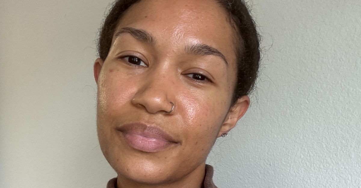 I Got Liquid Micro-Needling for My Acne, and It Was the Best Thing I've Ever Done for My Skin